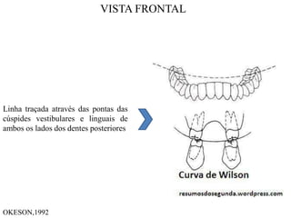 Linha traçada através das pontas das
cúspides vestibulares e linguais de
ambos os lados dos dentes posteriores
VISTA FRONTAL
OKESON,1992
 
