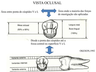 Área entre ponta de cúspides V e L Área onde a maioria das forças
de mastigação são aplicadas
Desde a ponta das cúspides até a
fossa central ou superfície V e L
VISTA OCLUSAL
OKESON,1992
 