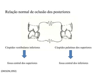 Relação normal de oclusão dos posteriores
Cúspides vestibulares inferiores Cúspides palatinas dos superiores
fossa central dos superiores fossa central dos inferiores
(OKESON,1992)
 