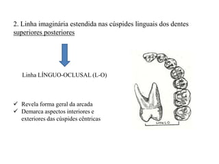 2. Linha imaginária estendida nas cúspides linguais dos dentes
superiores posteriores
Linha LÍNGUO-OCLUSAL (L-O)
 Revela forma geral da arcada
 Demarca aspectos interiores e
exteriores das cúspides cêntricas
 