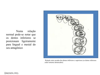 Numa relação
normal pode-se notar que
os dentes inferiores se
posicionam ligeiramente
para lingual e mesial do
seu antagônico
(OKESON,1992)
Relação entre arcadas dos dentes inferiores e superiores (os dentes inferiores
estão somente demarcados)
 