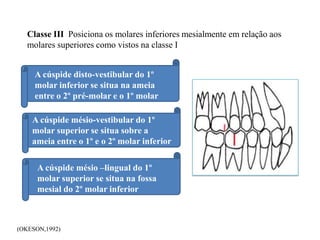 (OKESON,1992)
A cúspide disto-vestibular do 1º
molar inferior se situa na ameia
entre o 2º pré-molar e o 1º molar
superior
A cúspide mésio-vestibular do 1º
molar superior se situa sobre a
ameia entre o 1º e o 2º molar inferior
A cúspide mésio –lingual do 1º
molar superior se situa na fossa
mesial do 2º molar inferior
Classe III Posiciona os molares inferiores mesialmente em relação aos
molares superiores como vistos na classe I
 