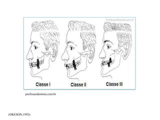 profissaodentista.com.br
(OKESON,1992)
 