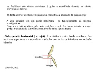 A finalidade dos dentes anteriores é guiar a mandíbula durante os vários
movimentos laterais
O dente anterior que fornece guia para a mandíbula é chamado de guia anterior
A guia anterior tem um papel importante no funcionamento do sistema
mastigatório
Sua característica é ditada pela exata posição e relação dos dentes anteriores, o que
pode ser examinado tanto horizontalmente quanto verticalmente
• Sobreposição horizontal ( overjet): É a distância entre borda vestibular dos
incisivos superiores e a superfície vestibular dos incisivos inferiores em oclusão
cêntrica
(OKESON,1992)
 