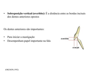 • Sobreposição vertical (overbite): É a distância entre as bordas incisais
dos dentes anteriores opostos
Os dentes anteriores são importantes:
• Para iniciar a mastigação
• Desempenham papel importante na fala
(OKESON,1992)
 