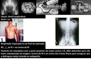 Chassi: 35x43 longitudinal
DFoFi: 1m




Respiração: Exposição na ao final da expiração
RC: _I_ ao RI > no centro do RI
Paciente em ortostático com a parte posterior do corpo contra o RI. Mão abduzidas para não
haver sobreposição de imagem. Centro do RI 5 cm acima das Cristas Íliacas para assegurar que
o diafragma esteja incluído na radiografia.
 