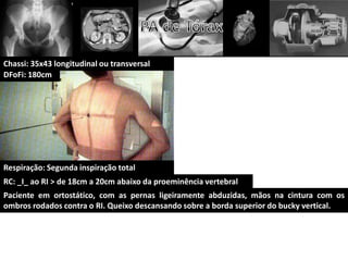 Chassi: 35x43 longitudinal ou transversal
DFoFi: 180cm




Respiração: Segunda inspiração total
RC: _I_ ao RI > de 18cm a 20cm abaixo da proeminência vertebral
Paciente em ortostático, com as pernas ligeiramente abduzidas, mãos na cintura com os
ombros rodados contra o RI. Queixo descansando sobre a borda superior do bucky vertical.
 