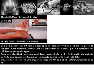 Chassi: 18x24cm – horizontal dividido
DFoFi: 1m




RC: 40º cefálico > Base do 3º metatarso
Colocar o paciente em DD com a cabeça apoiada sobre um travesseiro. Estender a perna do
calcâneo a ser estudado. Colocar em AP verdadeiro de maneira que o sustentáculo do
calcâneo apareça na imagem.
Fazer uma dorsiflexão para que o pé fique perpendicular ao RI. Pedir auxílio do paciente
pedindo-o para puxar com firmeza um torniquete ou um avental na direção dele.
OBS.: Pode ser necessário uma angulação superior a 40º se o pé não estiver perpendicular ao
RI.
 