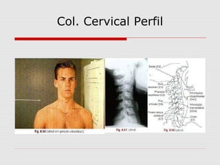 Col. Cervical Perfil

 