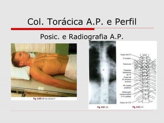 Col. Torácica A.P. e Perfil
Posic. e Radiografia A.P.

 