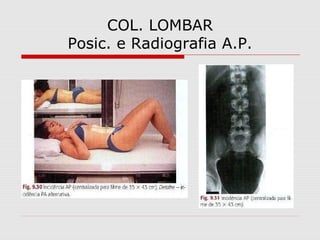 COL. LOMBAR
Posic. e Radiografia A.P.

 