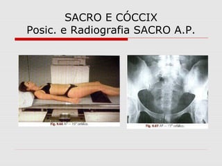 SACRO E CÓCCIX
Posic. e Radiografia SACRO A.P.

 
