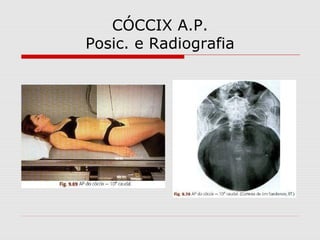 CÓCCIX A.P.
Posic. e Radiografia

 
