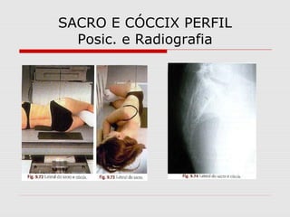 SACRO E CÓCCIX PERFIL
Posic. e Radiografia

 