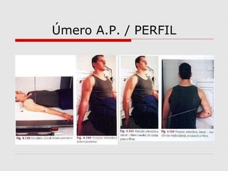 Úmero A.P. / PERFIL

 