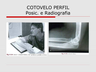COTOVELO PERFIL
Posic. e Radiografia

 