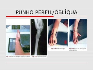 PUNHO PERFIL/OBLÍQUA

 