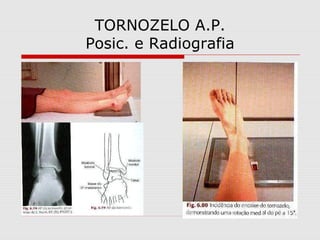 TORNOZELO A.P.
Posic. e Radiografia

 