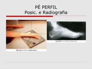 PÉ PERFIL
Posic. e Radiografia

 
