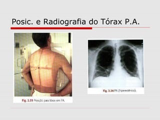 Posic. e Radiografia do Tórax P.A.

 