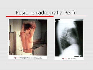 Posic. e radiografia Perfil

 