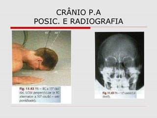 CRÂNIO P.A
POSIC. E RADIOGRAFIA

 
