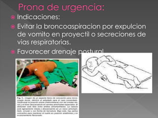  Indicaciones: 
 Evitar la broncoaspiracion por expulcion 
de vomito en proyectil o secreciones de 
vias respiratorias. 
 Favorecer drenaje postural. 
 