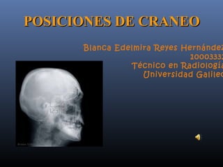 POSICIONES DE CRANEO
      Blanca Edelmira Reyes Hernández
                              10003332
                Técnico en Radiología
                   Universidad Galileo
 