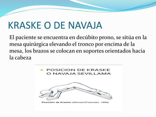 KRASKE O DE NAVAJA
El paciente se encuentra en decúbito prono, se sitúa en la
mesa quirúrgica elevando el tronco por encima de la
mesa, los brazos se colocan en soportes orientados hacia
la cabeza
 