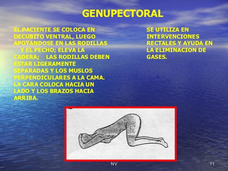 Posiciones Del Paciente Y Sus Usos