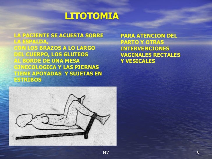 Posiciones Del Paciente Y Sus Usos Posiciones Del Paciente Y Sus Usos