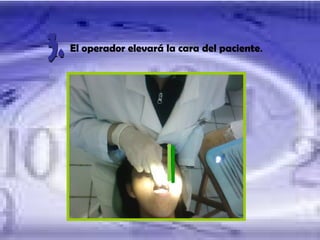 El operador elevará la cara del paciente . 3. 