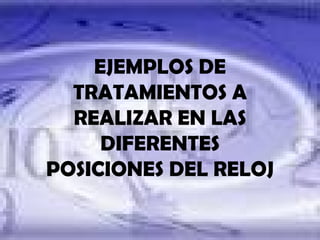 POSICIONES DE  RELOJ EJEMPLOS DE TRATAMIENTOS A REALIZAR EN LAS DIFERENTES POSICIONES DEL RELOJ 
