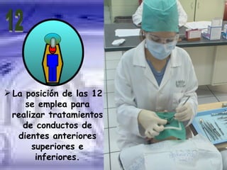 POSICIONES DE  RELOJ 12 La posición de las 12 se emplea para realizar tratamientos de conductos de dientes anteriores superiores e inferiores. 