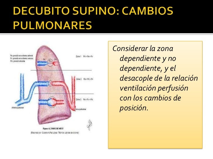 Posiciones en anestesia Ventilación y Perfusión Pulmonar en posturas Prono y Supino