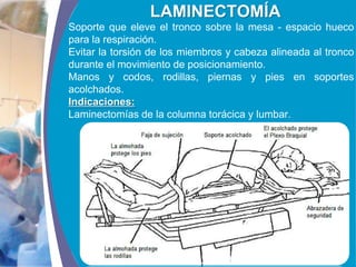COMPANY LOGO
www.themegallery.com
LAMINECTOMÍA
Soporte que eleve el tronco sobre la mesa - espacio hueco
para la respiración.
Evitar la torsión de los miembros y cabeza alineada al tronco
durante el movimiento de posicionamiento.
Manos y codos, rodillas, piernas y pies en soportes
acolchados.
Indicaciones:
Laminectomías de la columna torácica y lumbar.
 