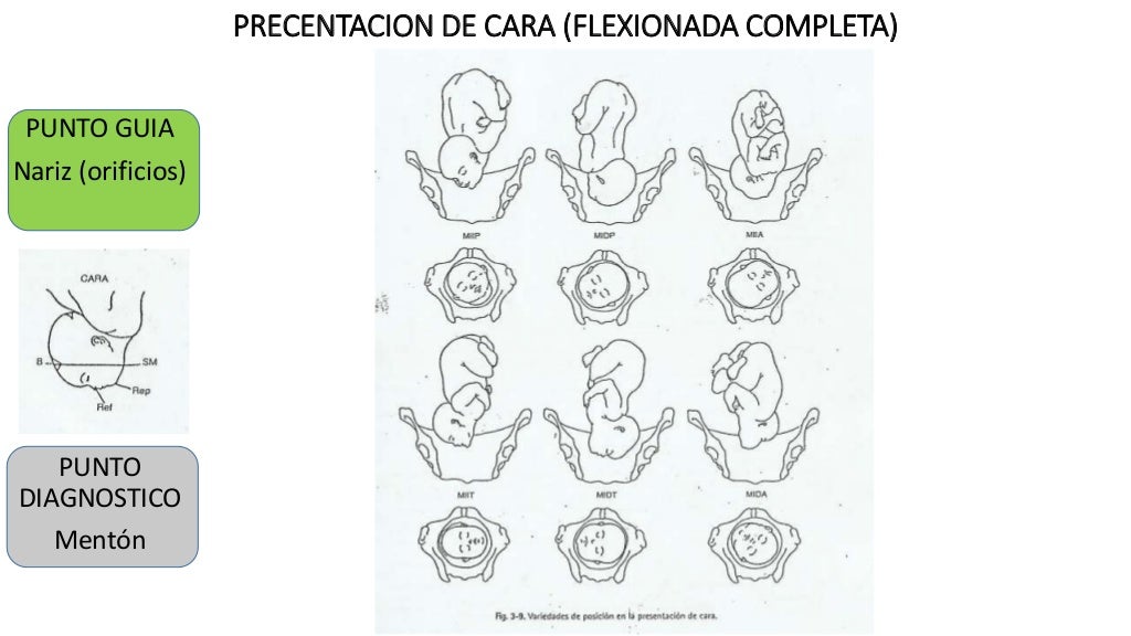 Fetal presentation Fetal presentation