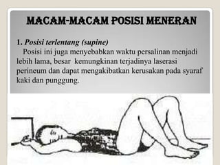 MACAM-MACAM POSISI MENERAN
1. Posisi terlentang (supine)
Posisi ini juga menyebabkan waktu persalinan menjadi
lebih lama, besar kemungkinan terjadinya laserasi
perineum dan dapat mengakibatkan kerusakan pada syaraf
kaki dan punggung.

 