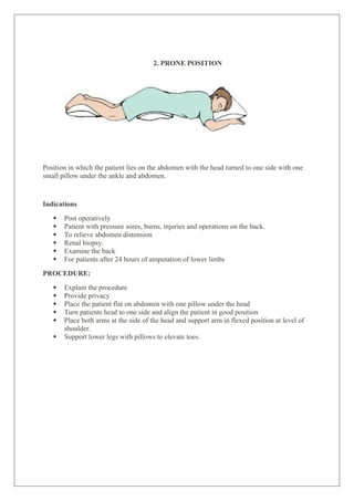 2. PRONE POSITION
Position in which the patient lies on the abdomen with the head turned to one side with one
small pillow under the ankle and abdomen.
Indications
 Post operatively
 Patient with pressure sores, burns, injuries and operations on the back.
 To relieve abdomen distension
 Renal biopsy.
 Examine the back
 For patients after 24 hours of amputation of lower limbs
PROCEDURE:
 Explain the procedure
 Provide privacy
 Place the patient flat on abdomen with one pillow under the head
 Turn patients head to one side and align the patient in good position
 Place both arms at the side of the head and support arm in flexed position at level of
shoulder.
 Support lower legs with pillows to elevate toes.
 