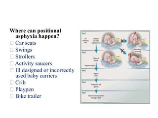 Where can positional
asphyxia happen?
Car seats
Swings
Strollers
Activity saucers
Ill designed or incorrectly
used baby carriers
Crib
Playpen
Bike trailer
 
