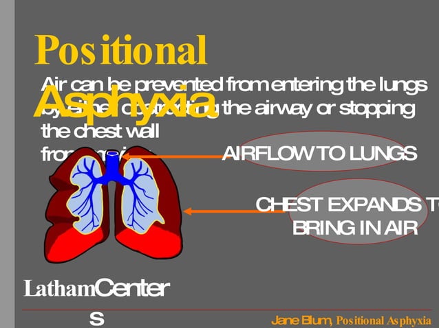 Positional asphyxia | PPT