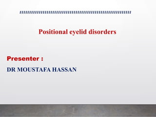 Positional eyelid disorders
Presenter :
DR MOUSTAFA HASSAN
 