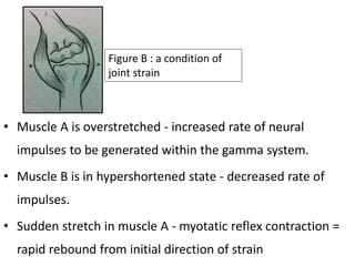 • Muscle A is overstretched - increased rate of neural
impulses to be generated within the gamma system.
• Muscle B is in hypershortened state - decreased rate of
impulses.
• Sudden stretch in muscle A - myotatic reflex contraction =
rapid rebound from initial direction of strain
Figure B : a condition of
joint strain
 