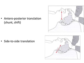 • Antero-posterior translation
(shunt, shift)
• Side-to-side translation
 
