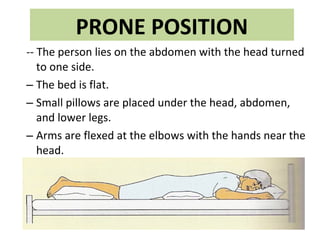 PRONE POSITION
-- The person lies on the abdomen with the head turned
to one side.
– The bed is flat.
– Small pillows are placed under the head, abdomen,
and lower legs.
– Arms are flexed at the elbows with the hands near the
head.
 