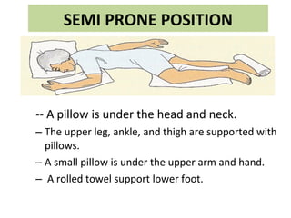 SEMI PRONE POSITION
-- A pillow is under the head and neck.
– The upper leg, ankle, and thigh are supported with
pillows.
– A small pillow is under the upper arm and hand.
– A rolled towel support lower foot.
 