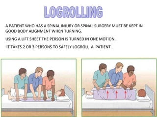 A PATIENT WHO HAS A SPINAL INJURY OR SPINAL SURGERY MUST BE KEPT IN
GOOD BODY ALIGNMENT WHEN TURNING.
USING A LIFT SHEET THE PERSON IS TURNED IN ONE MOTION.
IT TAKES 2 OR 3 PERSONS TO SAFELY LOGROLL A PATIENT.
 