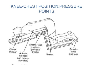 KNEE-CHEST POSITION:PRESSURE
POINTS
 