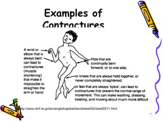 Contractures Examples positioning and moving an adult patients | PPT
