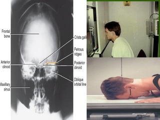all about x-ray positioning positioning.ppt